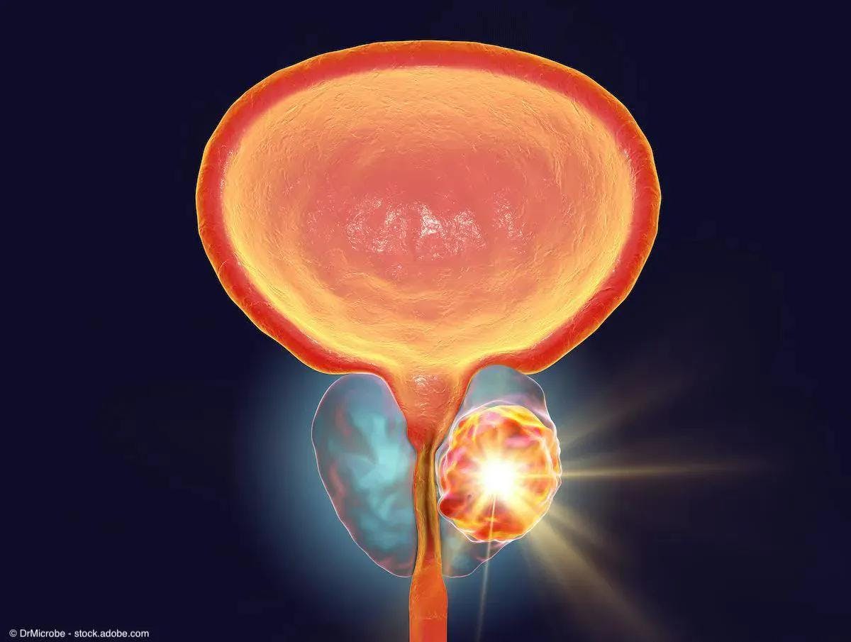 “The considerations surrounding salvage therapy in prostate cancer have significantly evolved with the emergence of improved imaging and therapeutics," says Dan Lin, MD.