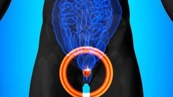 FDA authorizes trial of imaging agent for PSMA-negative prostate cancer patients