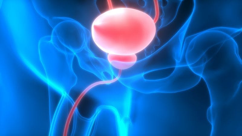 Erdafitinib combined with cetrelimab shows promise in bladder cancer