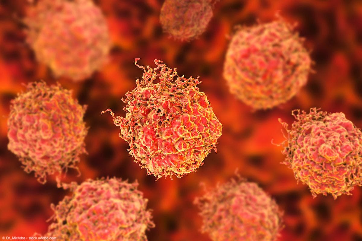 Blood-based test shows promise in prostate cancer risk stratification
