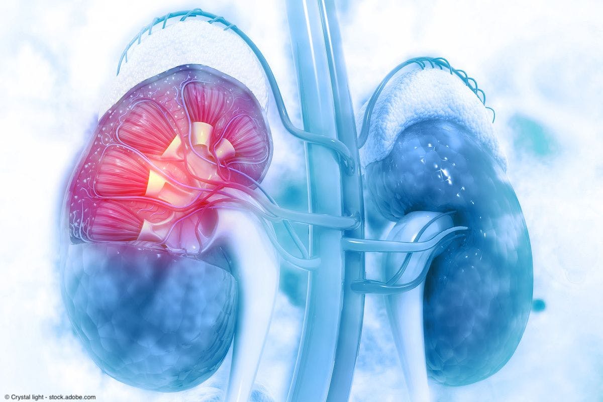 Update further supports belzutifan use for advanced renal cell carcinoma