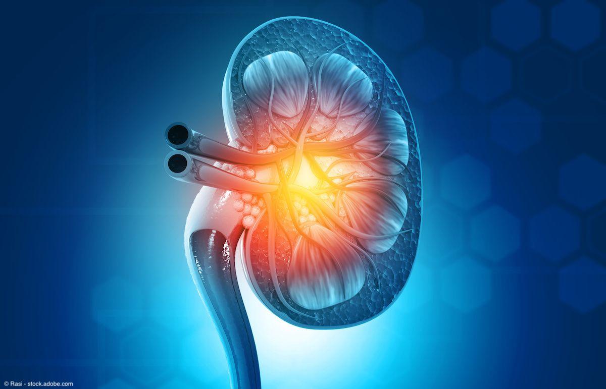 Mitochondrial metabolism may promote kidney cancer metastasis, new data show